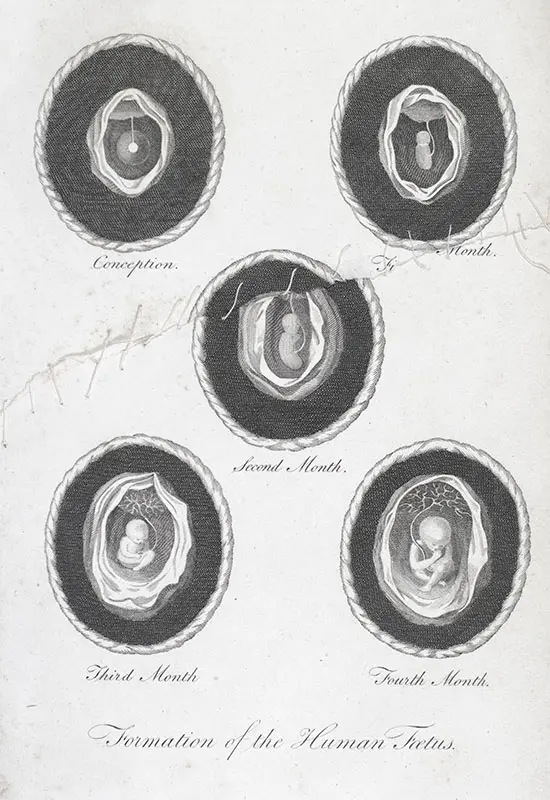The Medical Mirror, or Treatise on the Impregnation of the Human Female, Shewing the Origin of Diseases And the Principles of Death.