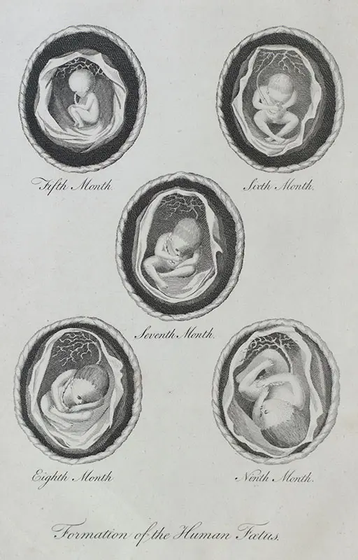 The Medical Mirror, or Treatise on the Impregnation of the Human Female, Shewing the Origin of Diseases And the Principles of Death.