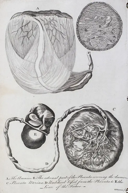 The Medical Mirror, or Treatise on the Impregnation of the Human Female, Shewing the Origin of Diseases And the Principles of Death.