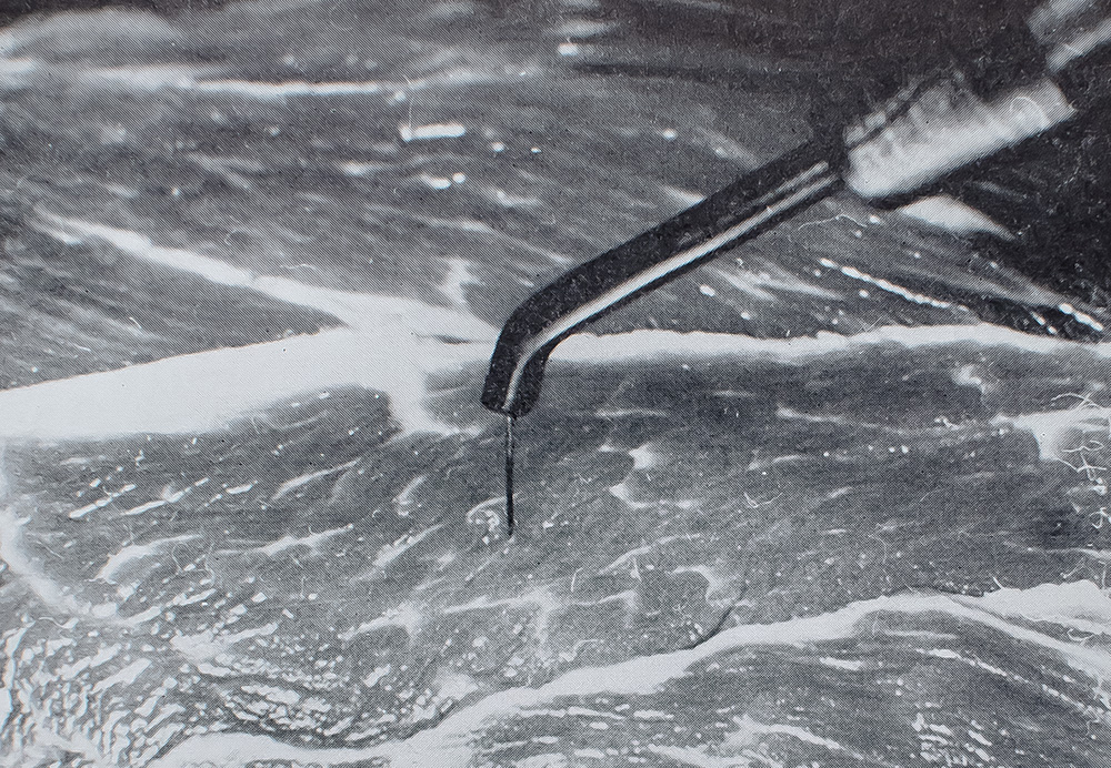 Electrosurgery in Dentistry.